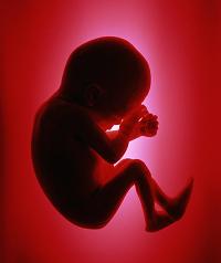 abortion